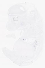 EMAGE:21017