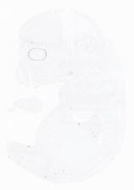 EMAGE:21017