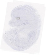 EMAGE:21017