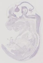 EMAGE:21035