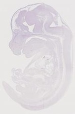 EMAGE:21062