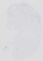 EMAGE:21130