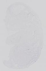 EMAGE:21142