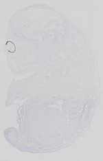 EMAGE:21142