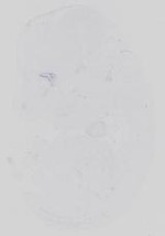 EMAGE:21142