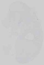 EMAGE:21153