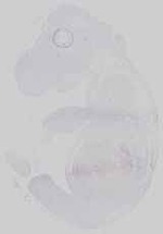 EMAGE:21153