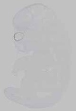 EMAGE:21162