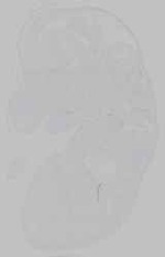 EMAGE:21162