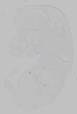 EMAGE:21162