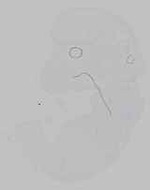 EMAGE:21162