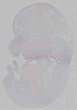 EMAGE:21163