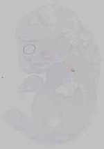 EMAGE:21164