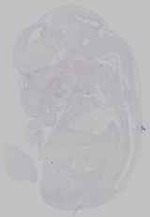 EMAGE:21164