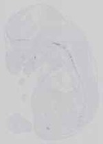 EMAGE:21181
