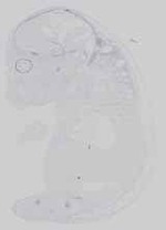 EMAGE:21182
