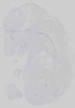 EMAGE:21182