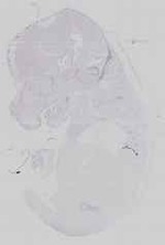 EMAGE:21182