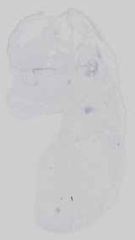 EMAGE:21182