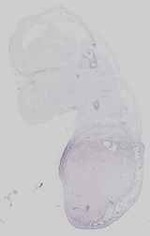 EMAGE:21182