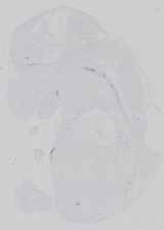 EMAGE:21183
