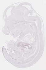 EMAGE:21450