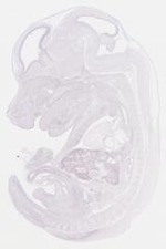 EMAGE:21452