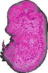 mouse atlas EMAGE spatial in situ gene expression database None