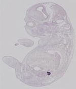 EMAGE:21591