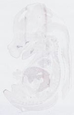 EMAGE:21628