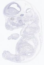 EMAGE:21639