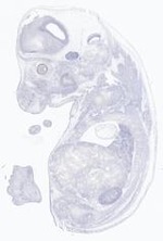 EMAGE:21639