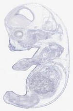 EMAGE:21641