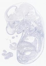 EMAGE:21641