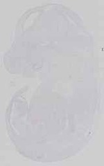 EMAGE:21649
