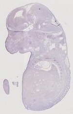 EMAGE:21661
