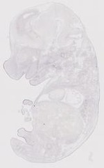 EMAGE:21667