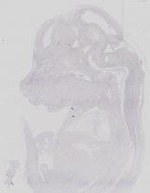 EMAGE:21671