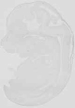 EMAGE:21675
