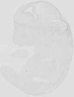 EMAGE:21677