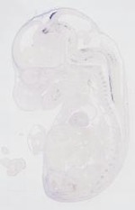 EMAGE:21715