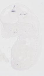 EMAGE:21715