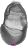 mouse atlas EMAGE spatial in situ gene expression database None