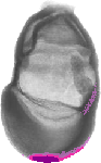 mouse atlas EMAGE spatial in situ gene expression database None