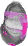 mouse atlas EMAGE spatial in situ gene expression database None