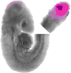 mouse atlas EMAGE spatial in situ gene expression database None