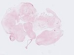 EMAGE:21854