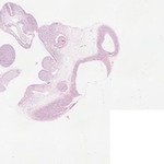 EMAGE:21910