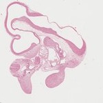 EMAGE:21916