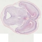 EMAGE:21961
